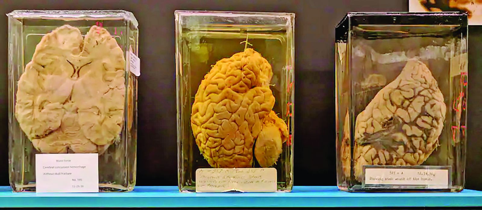 Bảo tàng những bộ não người